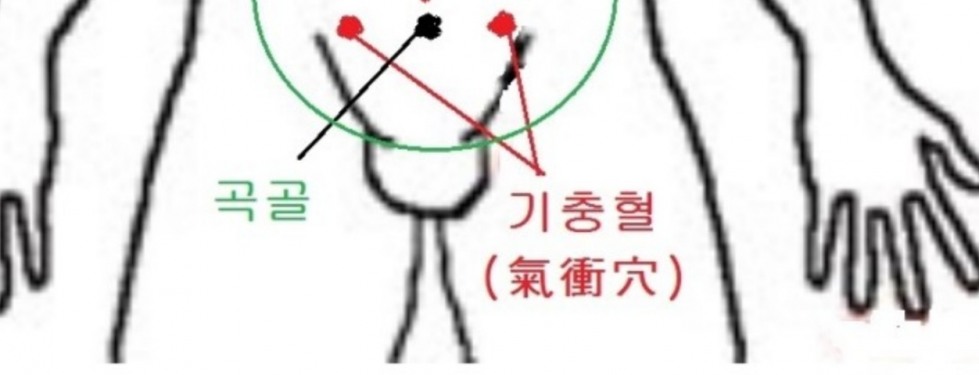 기충혈.jpg