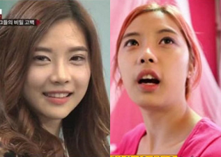 심현정_성형_전_후_박치기.jpg