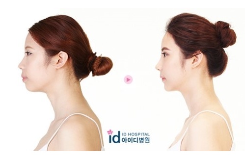 심현정_성형_전_후_2.jpg